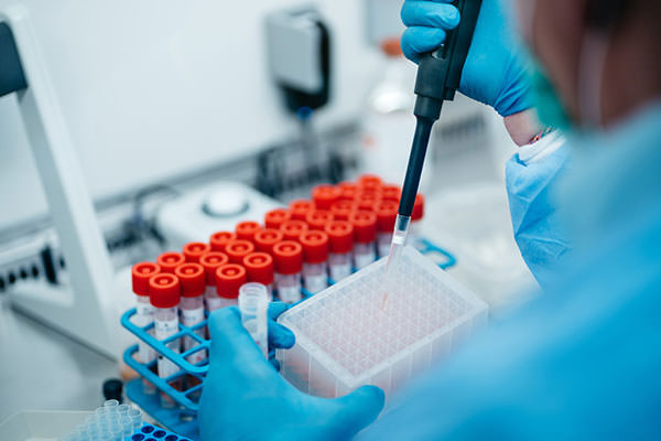 microbiologist-aliquoting-utm-into-assay-plate